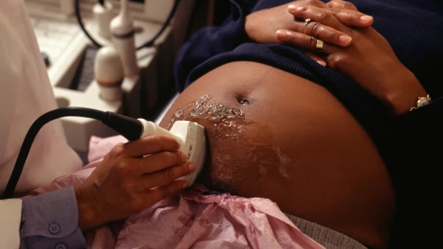 Doctor Examining a Pregnant Woman